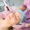 Microneedling - GS Distribuidor