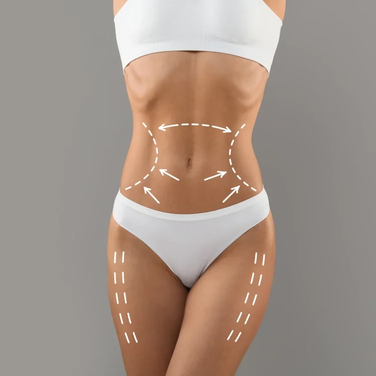 body-contouring-slim-female-torso-with-drawn-lifting-up-lines-it-scaled body-contouring-slim-female-torso-with-drawn-lifting-up-lines-it-scaled